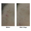 Picture of Korea Jelly Pop Bio-Cellulose Mask x 2 Boxes (10 pcs/box) 