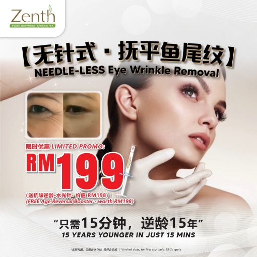 Picture of 1 X Needle-less Eye Wrinkle Removal Treatment